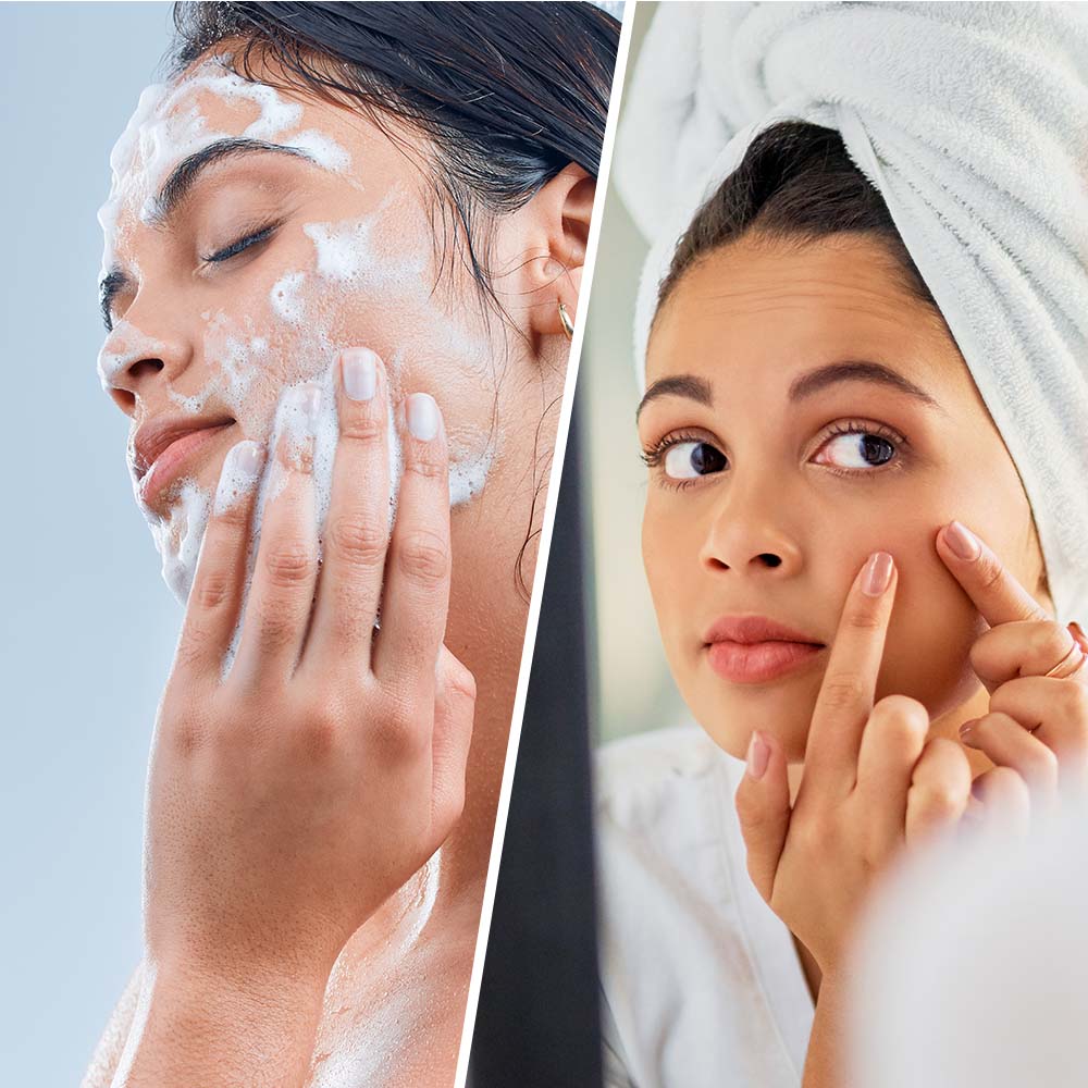SUPER CLEANSER Salicylic Acid + Organic Tea Tree Breakout Cleanser Face & Body